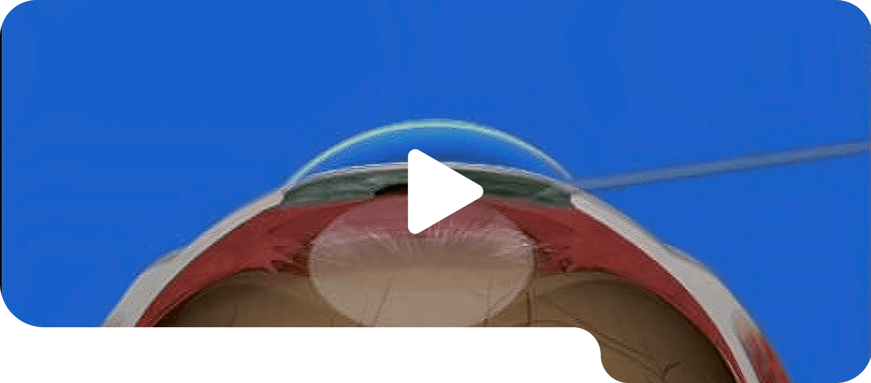 Lubricating eye drops